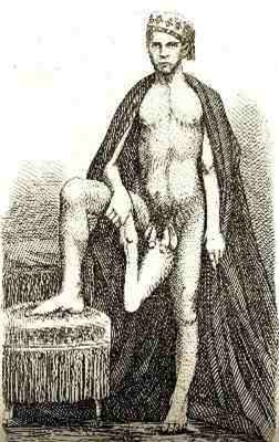 Chuyện tình cặp đôi cùng có 2 bộ phận sinh dục, Phi thường - kỳ quặc, cap doi cung co 2 bo phan sinh duc, Chuyen la, chuyện lạ, chuyenla, chuyen la co that, chuyen la kho tin