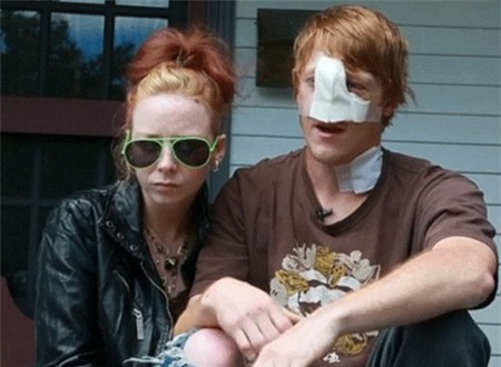 Bảo vệ bạn gái, bị chó cắn đứt mũi