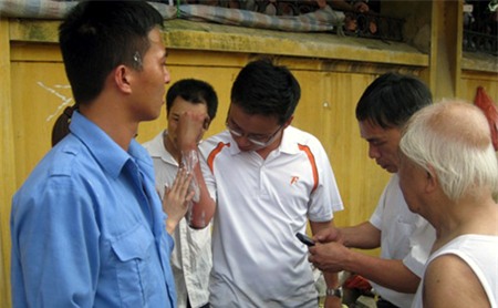 Một số người dân bị bỏng nhẹ.