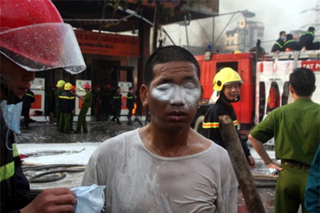 Nhiều người lo ngại sau đám cháy mắt sẽ bị sưng húp