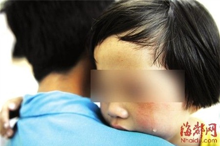 Bé gái 5 tuổi mắc bệnh lậu sau khi bị lạm dụng tình dục 1