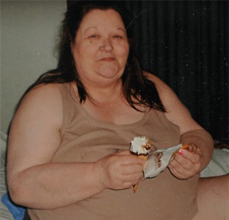 Phẫu thuật giảm cân: Mẹ mất mạng, con ngồi xe lăn