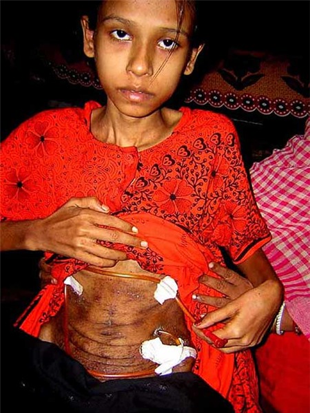 Ấn Độ: Mỗi giờ 1 phụ nữ chết vì của hồi môn | Ấn Độ, Phụ nữ Ấn Độ, Của hồi môn, Chết vì của hồi môn, Hủ tục