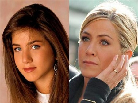 Nhìn lại sự thay đổi sau PTTM của 19 sao Hollywood đình đám 1
