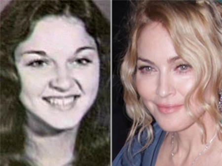 Nhìn lại sự thay đổi sau PTTM của 19 sao Hollywood đình đám 10