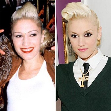 Nhìn lại sự thay đổi sau PTTM của 19 sao Hollywood đình đám 15