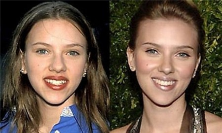 Nhìn lại sự thay đổi sau PTTM của 19 sao Hollywood đình đám 16