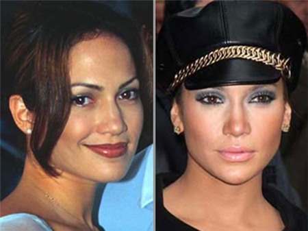 Nhìn lại sự thay đổi sau PTTM của 19 sao Hollywood đình đám 9