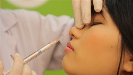 Chất làm đầy - Xu hướng mới của công nghệ thẩm mỹ 2