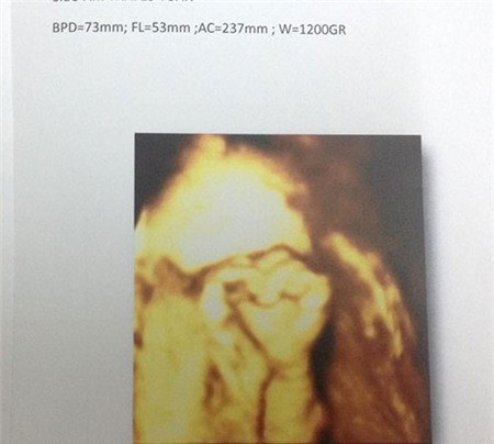 Xuân Lan khoe ảnh siêu âm 