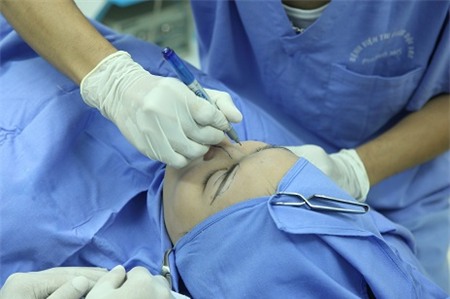 Nâng mũi silicone, sụn & tiêm - Đâu là phương pháp hoản hảo nhất 13