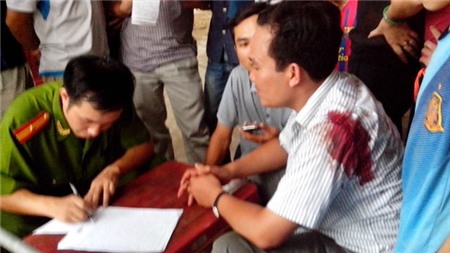 Cơ quan Công an làm việc với người bị hại ngay sau khi vụ việc xảy ra.