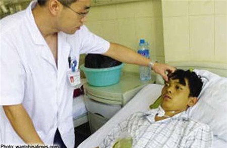 Da chuyển sang màu xanh lá vì ăn quá nhiều ốc sên 1