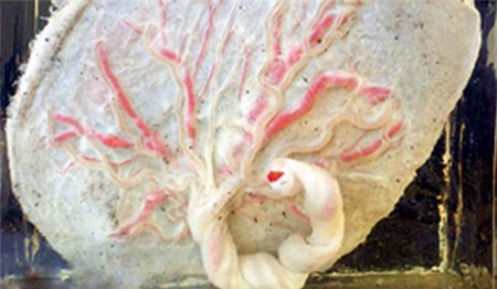 Thực hư chuyện ăn nhau thai tốt cho sức khỏe 1