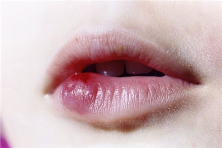 Bộ ảnh đầy xúc cảm về gia đình của một bà mẹ sinh đôi 5