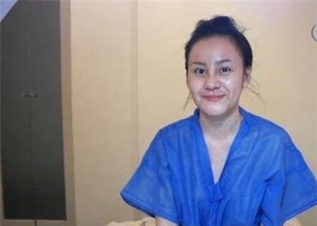  	Bà Tưng không ngần ngại chia sẻ những hình ảnh chưa được đẹp mắt sau khi vừa tháo chỉ phẫu thuật thẩm mỹ