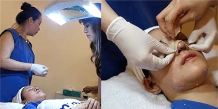 Bà Tưng không phẫu thuật để làm Can Lộ Lộ - 3