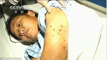 Kinh sợ loài ong khổng lồ, cực độc khiến 42 người vong mạng | Chuyện lạ 4 phương,Chuyện lạ thế giới,Phi thường,Chuyện lạ có thật,Chuyện lạ khó tin