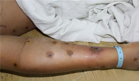 Kinh sợ loài ong khổng lồ, cực độc khiến 42 người vong mạng | Chuyện lạ 4 phương,Chuyện lạ thế giới,Phi thường,Chuyện lạ có thật,Chuyện lạ khó tin