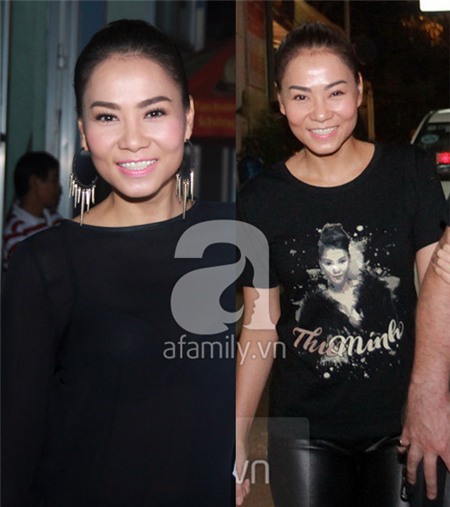 Nghi án Thu Minh tiêm botox căng da mặt 3