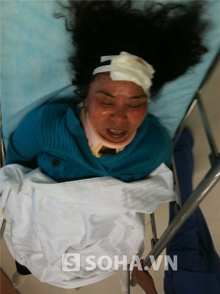 Bà Liên hiện đang được cấp cứu tại BV quốc tế Vinmec trong tình trạng chấn thương nặng.