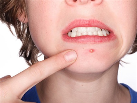 8 tác dụng làm đẹp cực hay từ chuối - 5