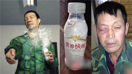 Hoảng hồn chai sữa chua uống phát nổ khiến mắt sưng vù 1