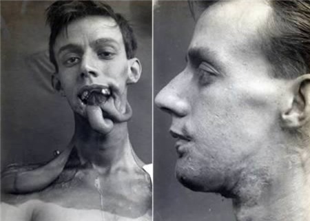 Những hình ảnh đầu tiên chưa biết tới về phẫu thuật thẩm mỹ 3