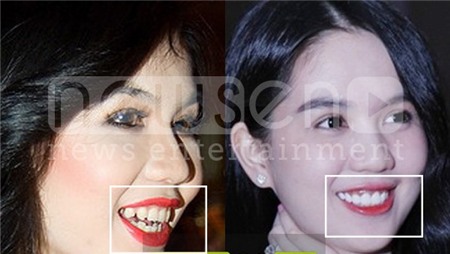 Sự khác biệt khi so với hiện tại