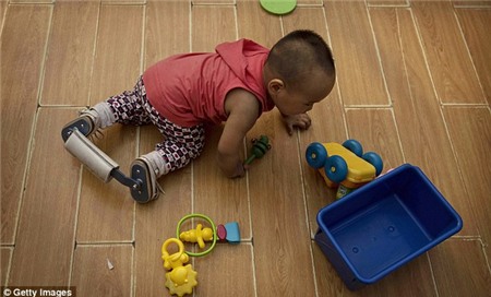 Một cậu bé mồ côi Trung Quốc bóc tách mang niềng răng chân khắc phục trên sàn nhà