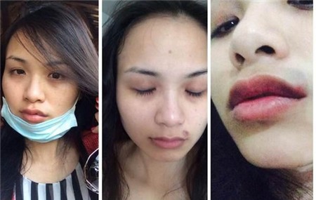 Hình ảnh sao Việt đau đớn vì bị bạo hành, tai nạn
