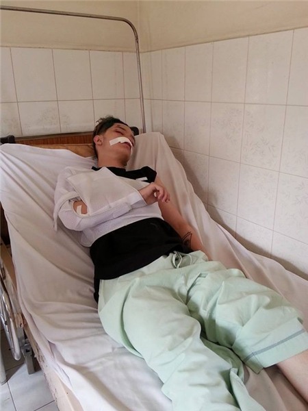 Hình ảnh sao Việt đau đớn vì bị bạo hành, tai nạn