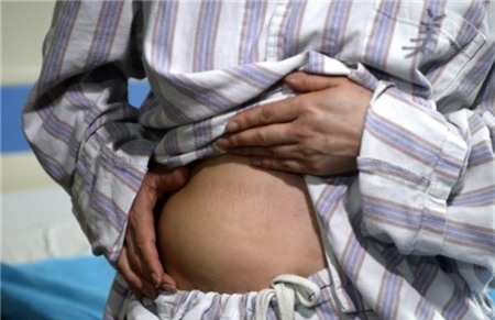 Hoảng hồn bộ ngực cấy ghép tụt xuống tận lưng và bụng 1