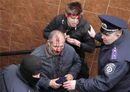 [Caption]Interior Ministry members stand near men, who were injured in clashes between pro-Russian and pro-Ukrainian supporters during their rallies, in Kharkiv, April 13, 2014. REUTERS