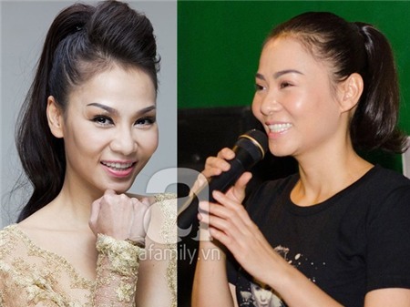 Sao châu Á tiêm botox: trẻ lên hay già đi cả chục tuổi? 4