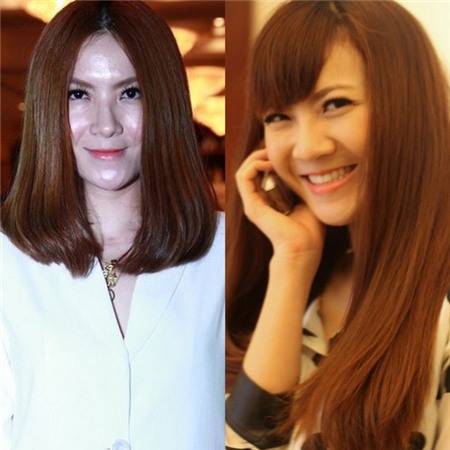 Sao châu Á tiêm botox: trẻ lên hay già đi cả chục tuổi? 6