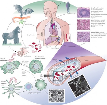 Cách phòng ngừa bệnh lây truyền Ebola chết người