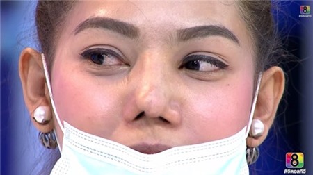 Cặp đôi Thái Lan bị biến dạng mũi do phẫu thuật thẩm mỹ hỏng 5