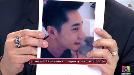 Cặp đôi Thái Lan bị biến dạng mũi do phẫu thuật thẩm mỹ hỏng 8