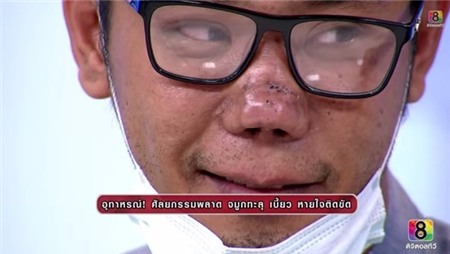 Cặp đôi Thái Lan bị biến dạng mũi do phẫu thuật thẩm mỹ hỏng 9