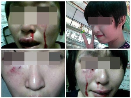 Chia sẻ của cô gái xinh đẹp bị chồng hành hạ khiến cộng đồng mạng nghẹn ngào 1