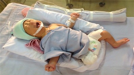 Nín thở dõi theo tình trạng bé sơ sinh văng khỏi bụng mẹ