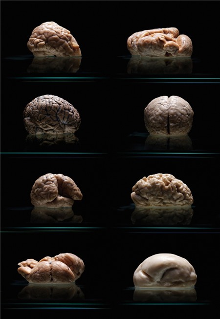 Các bộ não có hình dạng hiếm gặp hiện đang lưu giữ tại Bệnh viện tâm thần Austin