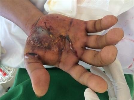 Rắn lục đuôi đỏ tấn công dân Hà Nội, làm sao để đuổi?