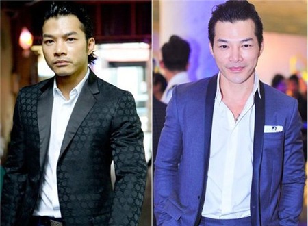 Sao nam Việt dính nghi án phẫu thuật mũi và cằm