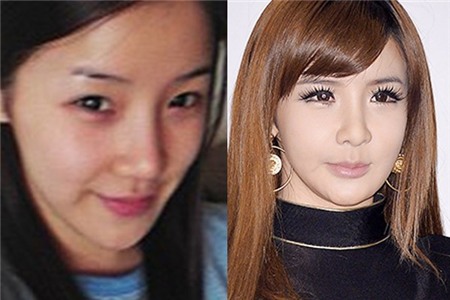 Những khuôn mặt méo mó gây sốc của loạt kiều nữ xứ Hàn 10