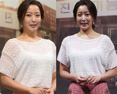 Những khuôn mặt méo mó gây sốc của loạt kiều nữ xứ Hàn 4