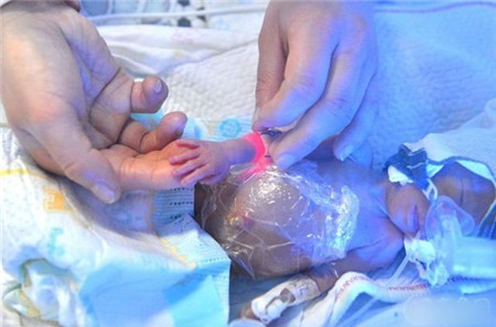 Bà mẹ sinh năm, em bé nhỏ nhất chỉ nặng nửa cân 1