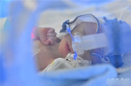 Bà mẹ sinh năm, em bé nhỏ nhất chỉ nặng nửa cân 3