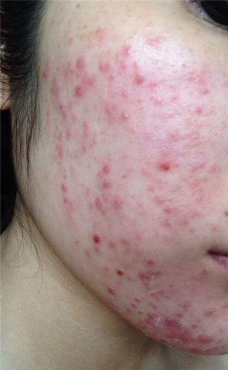 Khổ sở vì mỹ phẩm dán nhãn 